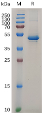 Recombinant human IL20 protein with C-terminal human Fc tag