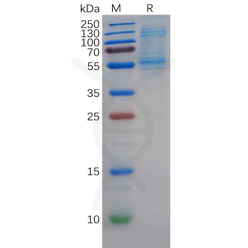 Recombinant Human DLL3 Protein, His Tag Recombinant Human DLL3 Protein, His Tag