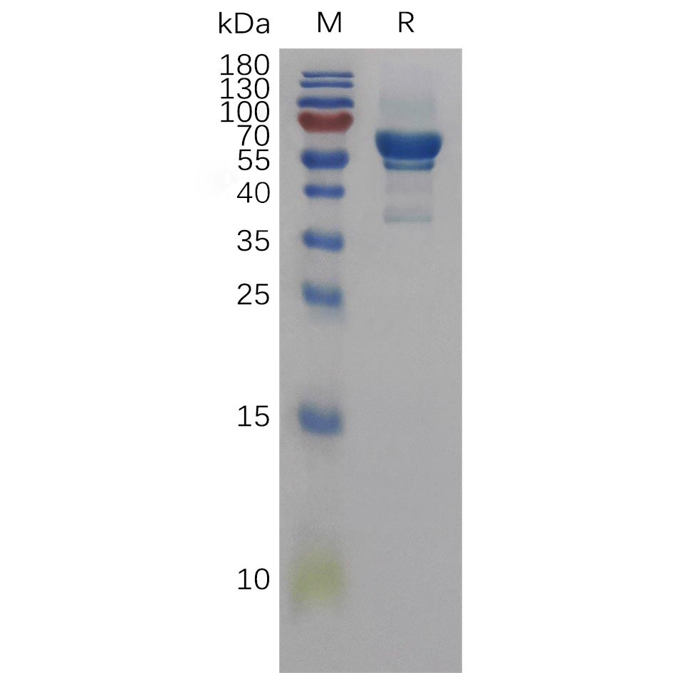 Recombinant Human AREG Protein, hFc Tag Recombinant Human AREG Protein, hFc Tag