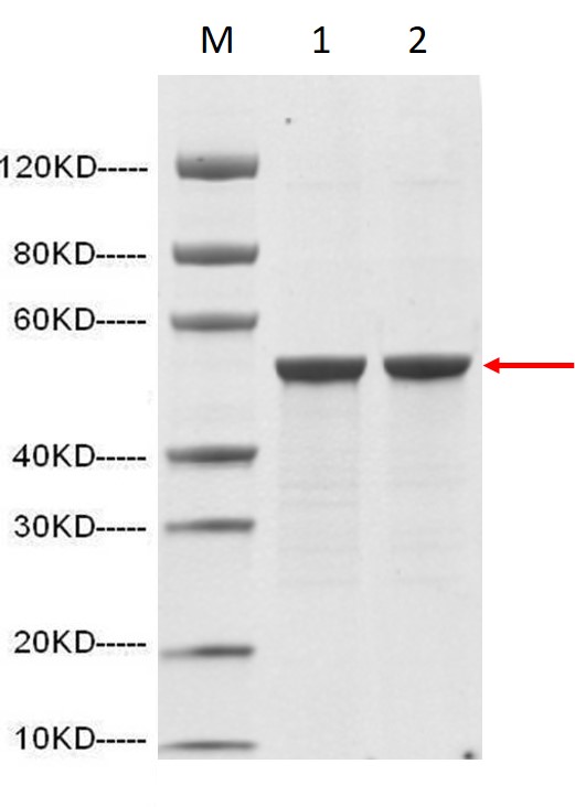 SARS-CoV-2/COVID-19/nCOV Nucleocapsid protein (His Tag)