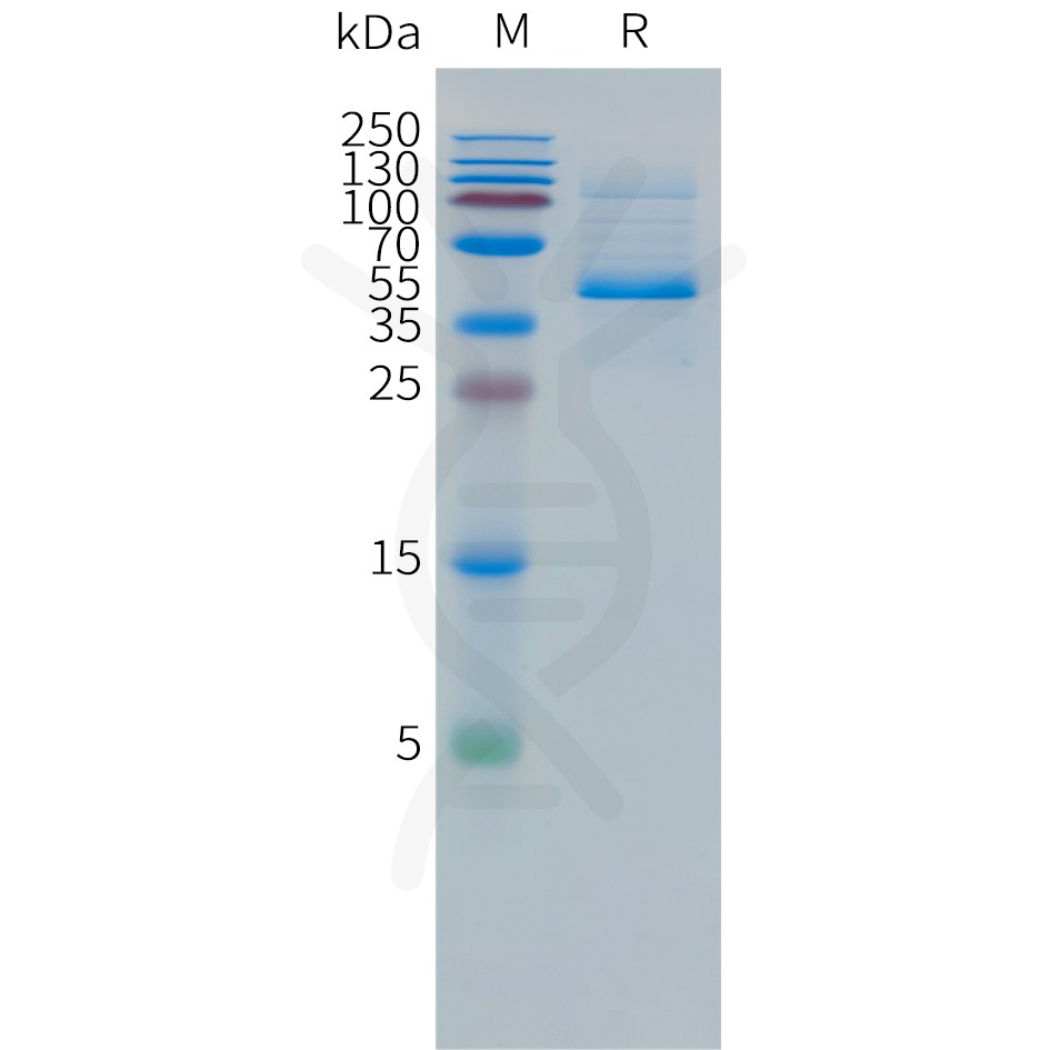 Human DLL3(352-492) Protein, hFc Tag Human DLL3(352-492) Protein, hFc Tag
