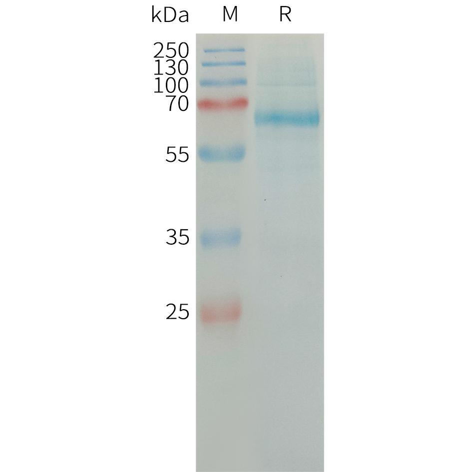 Human PLAT Protein, His Tag