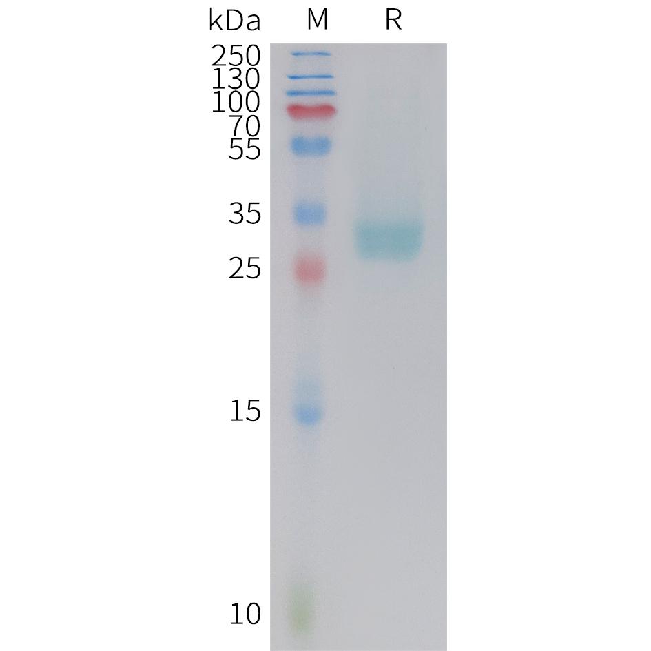 Cynomolgus PD-L1 Protein, His Tag