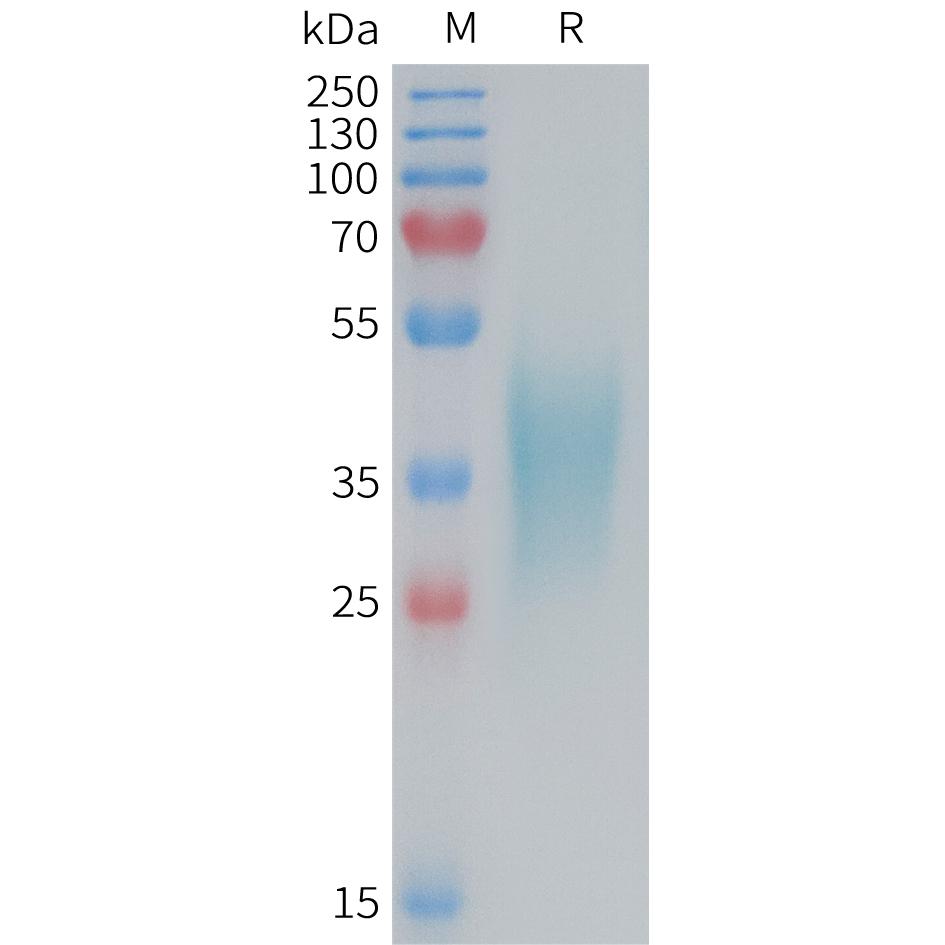 Mouse TNFRSF1B Protein, His Tag