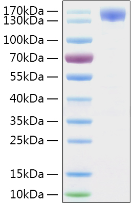 Fig 1 : Recombinant 2019-nCoV Spike S1 Protein was determined by SDS-PAGE with Coomassie Blue, showing a band at 130-160 kDa.