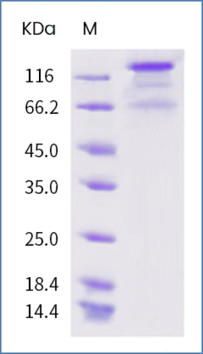 Fig.2: SDS-PAGE of SARS-CoV-2 (2019-nCoV) Spike Protein (S1 + S2 ECD, His tag)