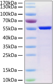 Recombinant SARS-CoV-2 Nucleocapsid Protein His Tag