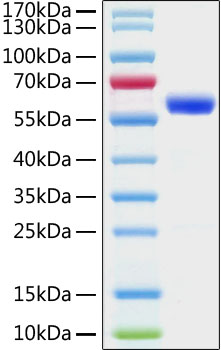 Recombinant SARS-CoV-2 Spike RBD Protein, mFc tag