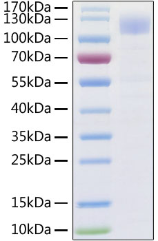 Recombinant SARS-CoV-2 Spike S1 Protein His tag