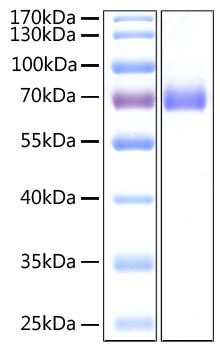 Recombinant SARS-CoV-2 Spike S2 ECD Protein His tag