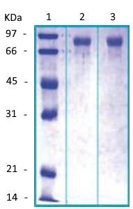 PI16 Recombinant Protein