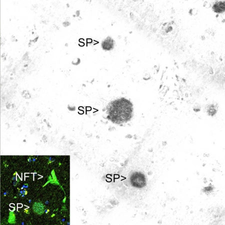 Monoclonal Antibody to Amyloid- Beta (Clone: AB9)