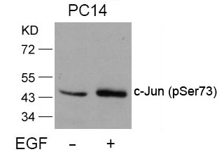 Polyclonal Antibody to c-Jun (Phospho-Ser73)