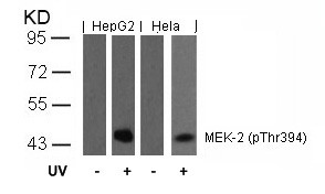 Polyclonal Antibody to MEK-2 (Phospho-Thr394)