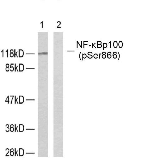 Polyclonal Antibody to NFkB-p100/p52(Phospho-Ser866)