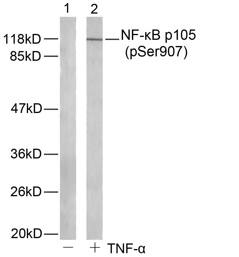 Polyclonal Antibody to NFkB-p105/p50(Phospho-Ser907)