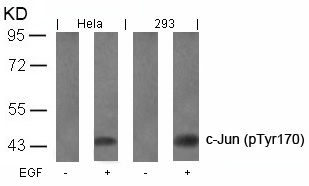 Polyclonal Antibody to c-Jun (Phospho-Tyr170)