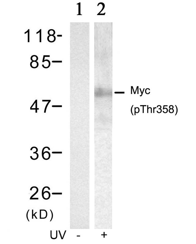 Polyclonal Antibody to Myc (Phospho-Thr358)