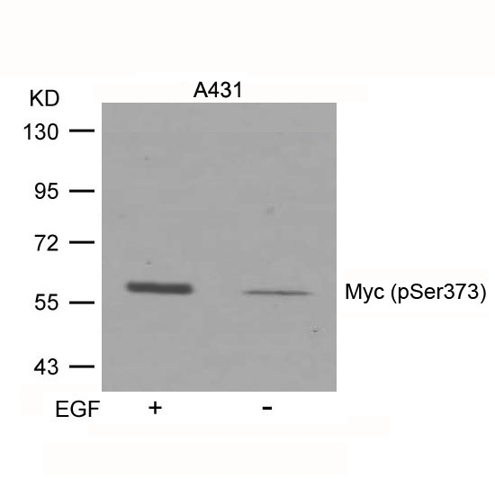 Polyclonal Antibody to Myc (Phospho-Ser373)