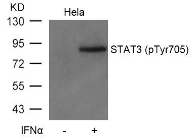 Polyclonal Antibody to STAT3 (Phospho-Tyr705)