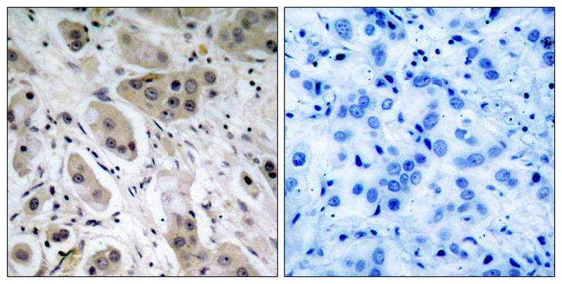 Polyclonal Antibody to Akt (Phospho-Ser473)