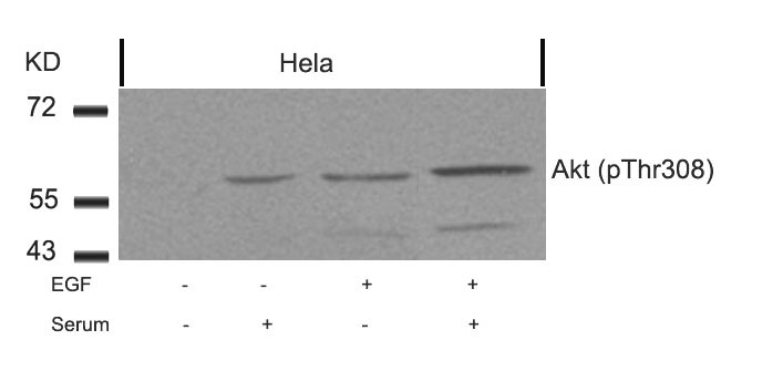 Polyclonal Antibody to Akt (Phospho-Thr308)