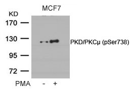 Polyclonal Antibody to PKD/PKC (Phospho-Ser738)