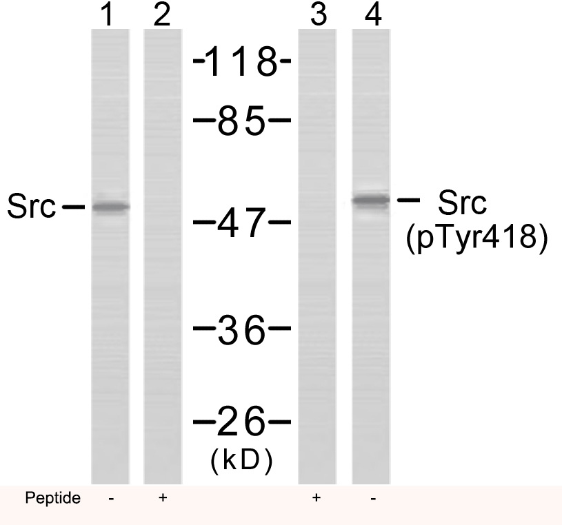 Polyclonal Antibody to Src(Phospho-Tyr418)
