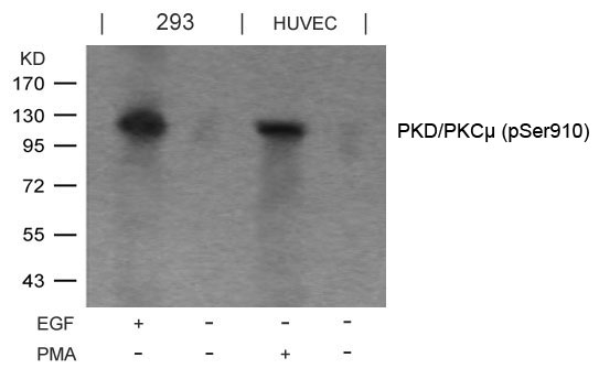 Polyclonal Antibody to PKD/PKC (Phospho-Ser910)
