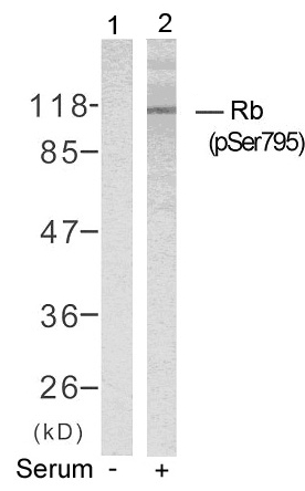 Polyclonal Antibody to Rb (Phospho-Ser795)