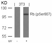 Polyclonal Antibody to Rb (Phospho-Ser807)