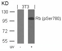 Polyclonal Antibody to Rb (Phospho-Ser780)
