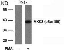 Polyclonal Antibody to MKK3 (Phospho-Ser189)