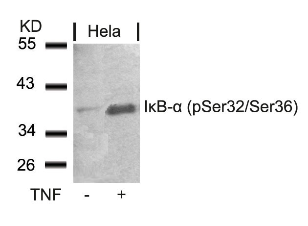 Polyclonal Antibody to IkB- Alpha (Phospho-Ser32/Ser36)