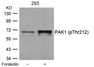 Polyclonal Antibody to PAK1 (Phospho-Thr212)