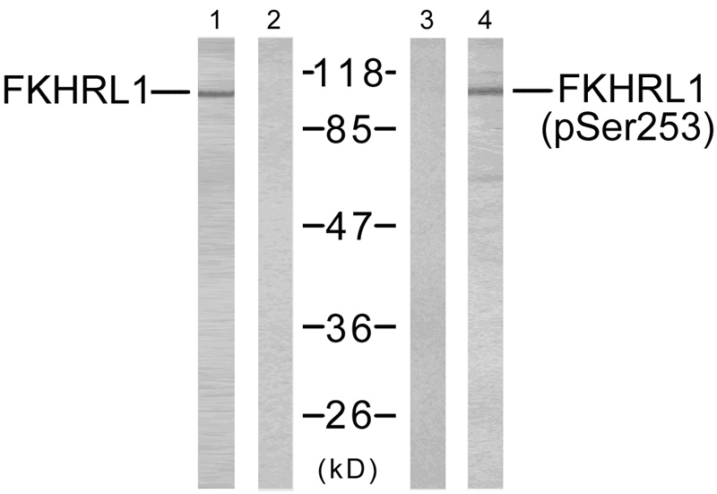 Polyclonal Antibody to FKHRL1(Phospho-Ser253)