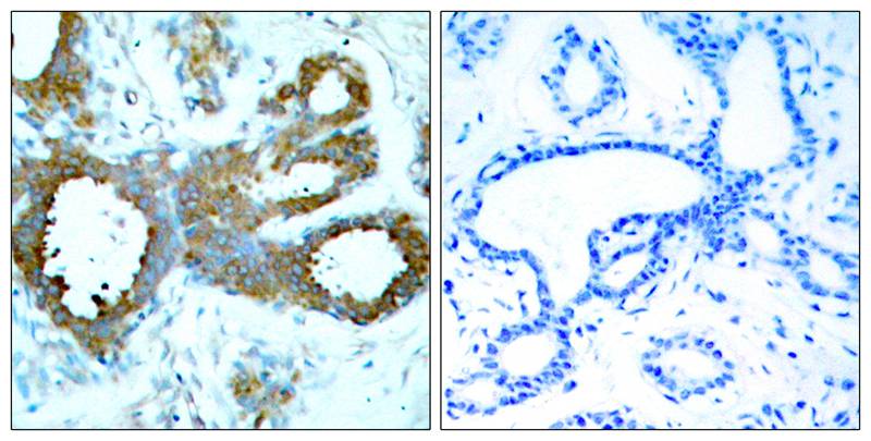 Polyclonal Antibody to PAK1/PAK2/PAK3 (Phospho-Thr423/Thr402/Thr421)