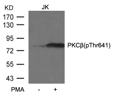 Polyclonal Antibody to PKCbeta (Phospho-Thr641)