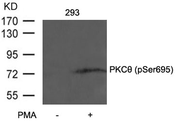 Polyclonal Antibody to PKC Theta (Phospho-Ser695)