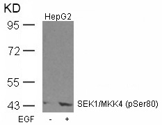 Polyclonal Antibody to SEK1/MKK4 (Phospho-Ser80)