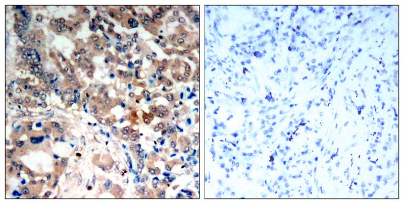 Polyclonal Antibody to AMPK Alpha1/AMPK Alpha2(Phospho-Thr183/Thr172)