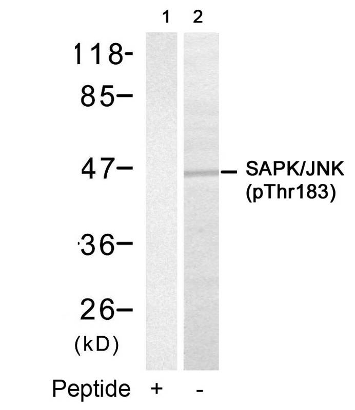 Polyclonal Antibody to SAPK/JNK (Phospho-Thr183)