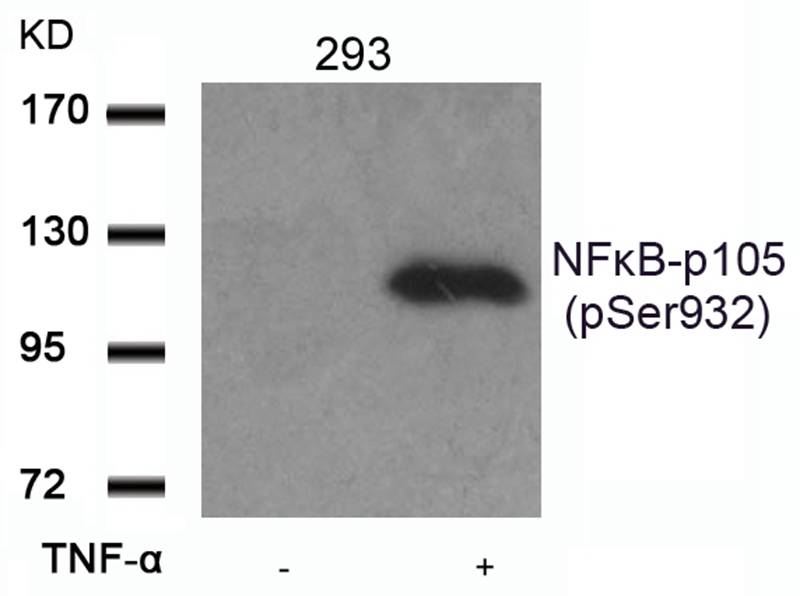 Polyclonal Antibody to NFkB-p105/p50 (Phospho-Ser932)