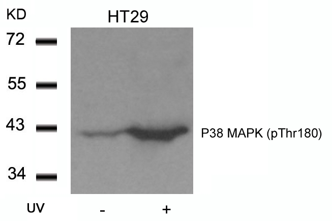 Polyclonal Antibody to P38 MAPK (Phospho-Thr180)
