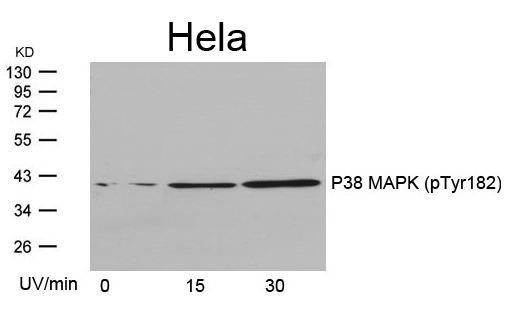 Polyclonal Antibody to P38 MAPK (Phospho-Tyr182)