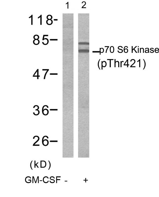 Polyclonal Antibody to p70 S6 Kinase (Phospho-Thr421)