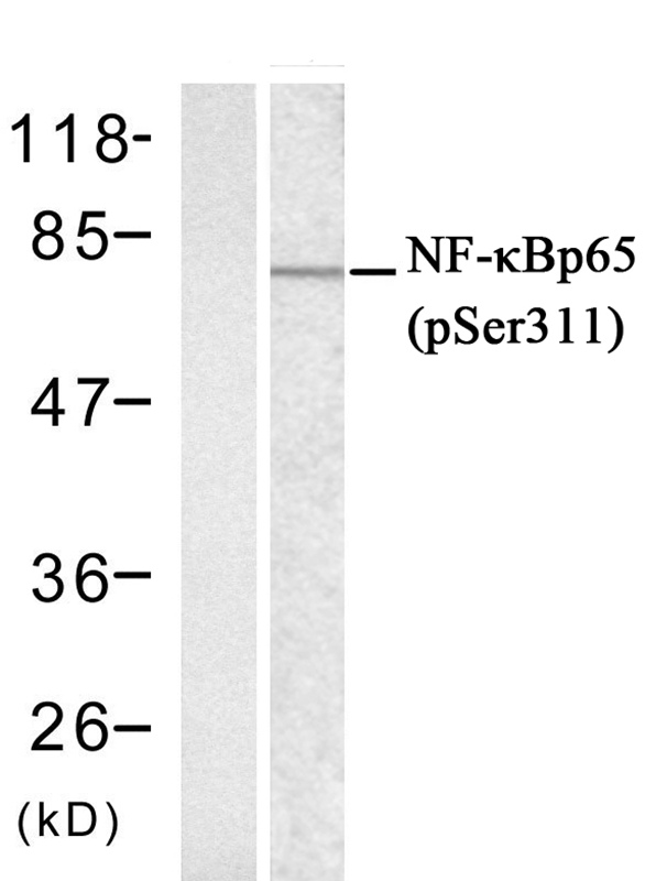 Polyclonal Antibody to NFkB-p65((phospho-Ser311)