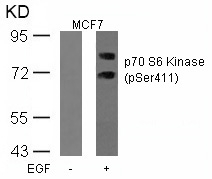 Polyclonal Antibody to p70 S6 Kinase (Phospho-Ser411)
