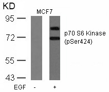 Polyclonal Antibody to p70 S6 Kinase (Phospho-Ser424)
