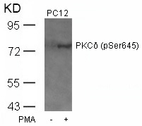 Polyclonal Antibody to PKC Delta (Phospho-Ser645)
